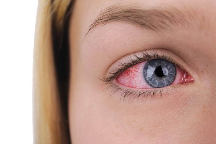 Say Goodbye to Allergic Reactions With This Gentle Lash Glue